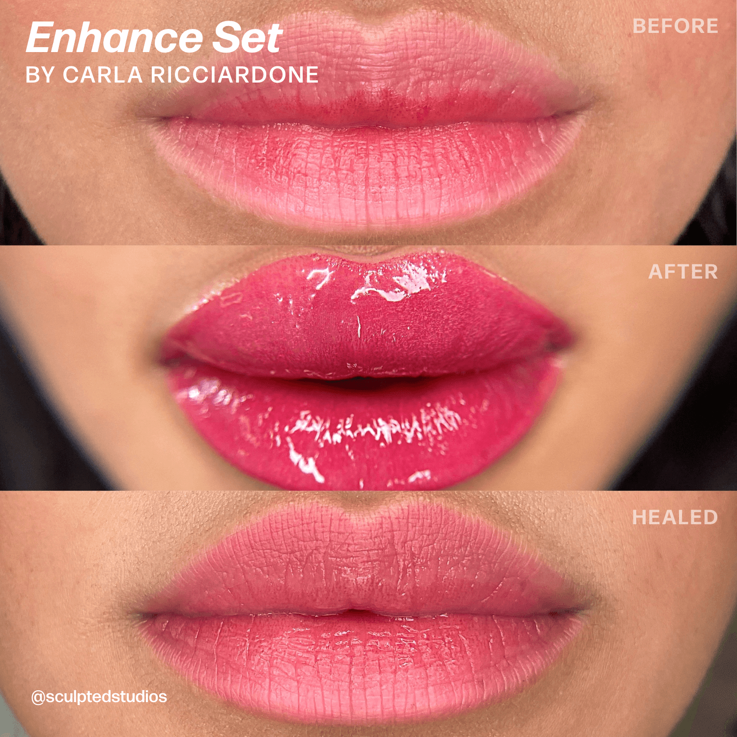 Carla Ricciardone Enhance Lip Set — Perma Blend — 8 1/2oz Bottles
