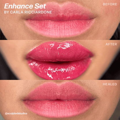 Carla Ricciardone Enhance Lip Set — Perma Blend — 8 1/2oz Bottles