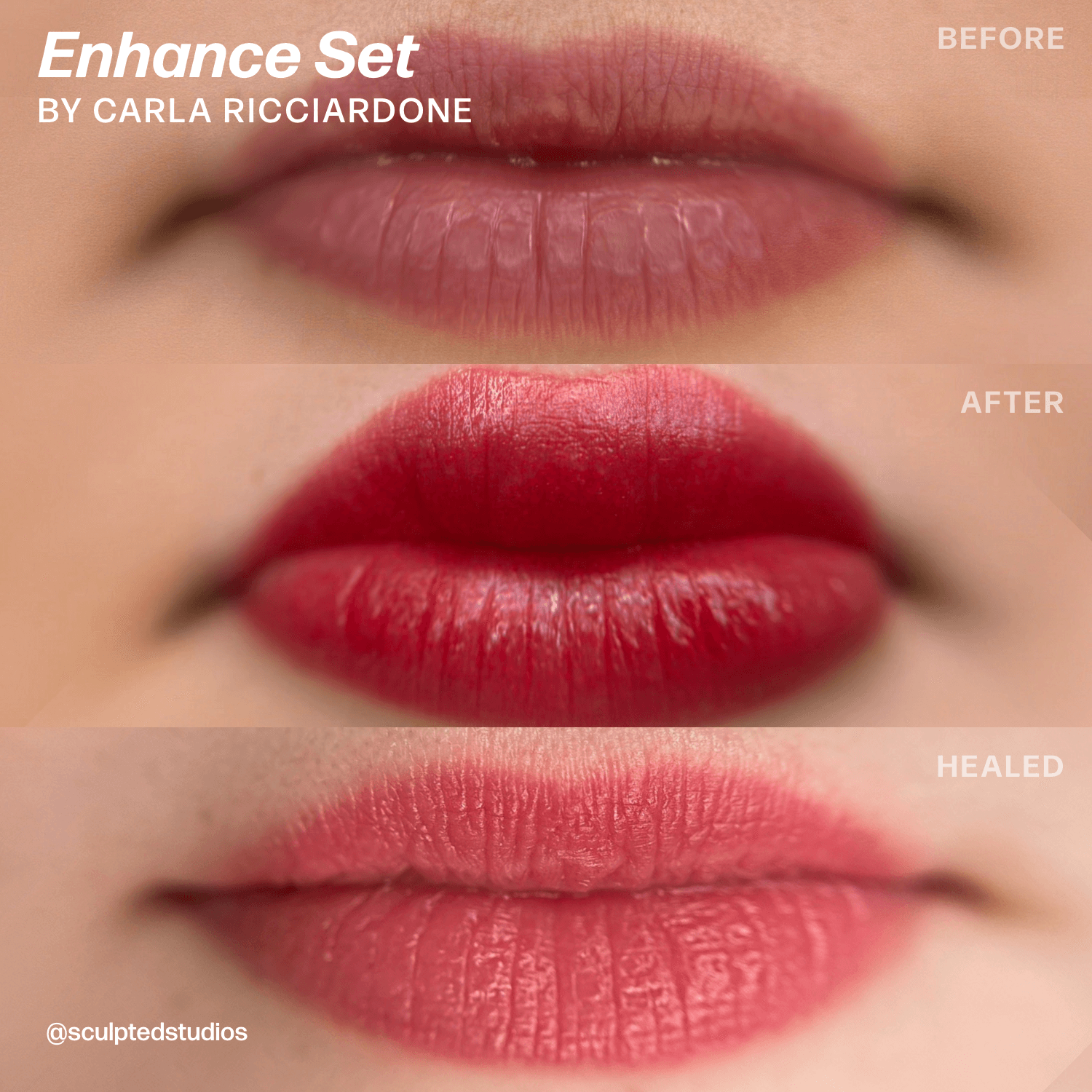 Carla Ricciardone Enhance Lip Set — Perma Blend — 8 1/2oz Bottles