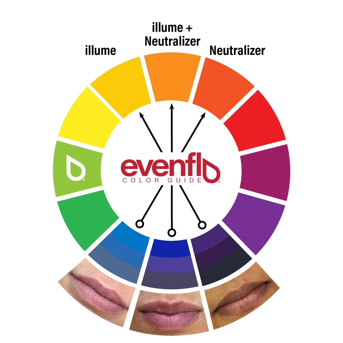 Evenflo Neutralizer Set — 3 1/2oz Bottles - Ultimate Beauty